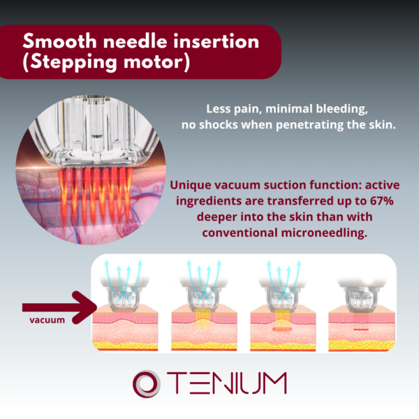 152 Portable radiofrequency mesotherapy machine up to 4mm SH10 mini - for tightening, lifting and treatment of the face and body