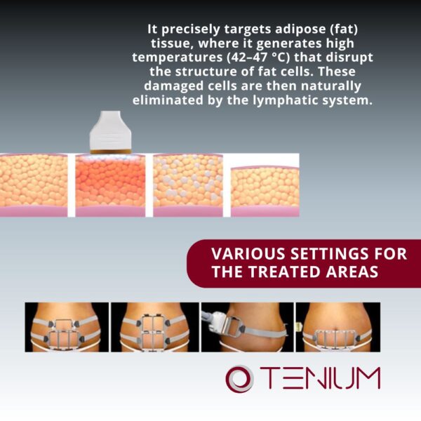 212 Diode laser JLRZ1060 - for non-invasive body shaping
