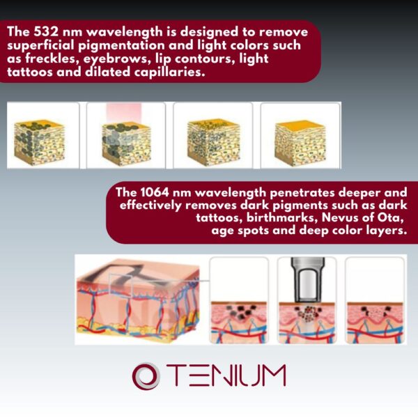 219 Q switch Nd:Yag laser JL6 - for tattoo removal, pigmentation and skin rejuvenation