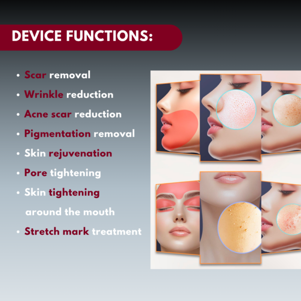 34 Erbium laser 2940nm SH20 – for skin resurfacing, rejuvenation, and renewal